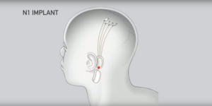 Neuralinkl